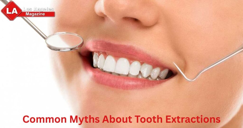 Common Myths About Tooth Extractions