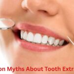 Common Myths About Tooth Extractions