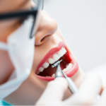 Discover the Best Options for Fillings in Vancouver, BC: Your Guide to Dental Health