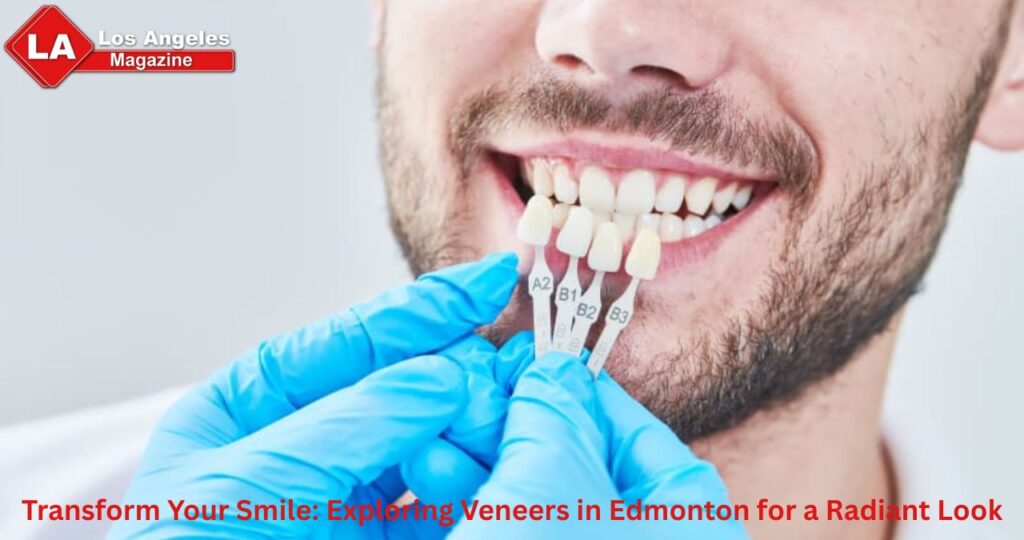 Transform Your Smile: Exploring Veneers in Edmonton for a Radiant Look